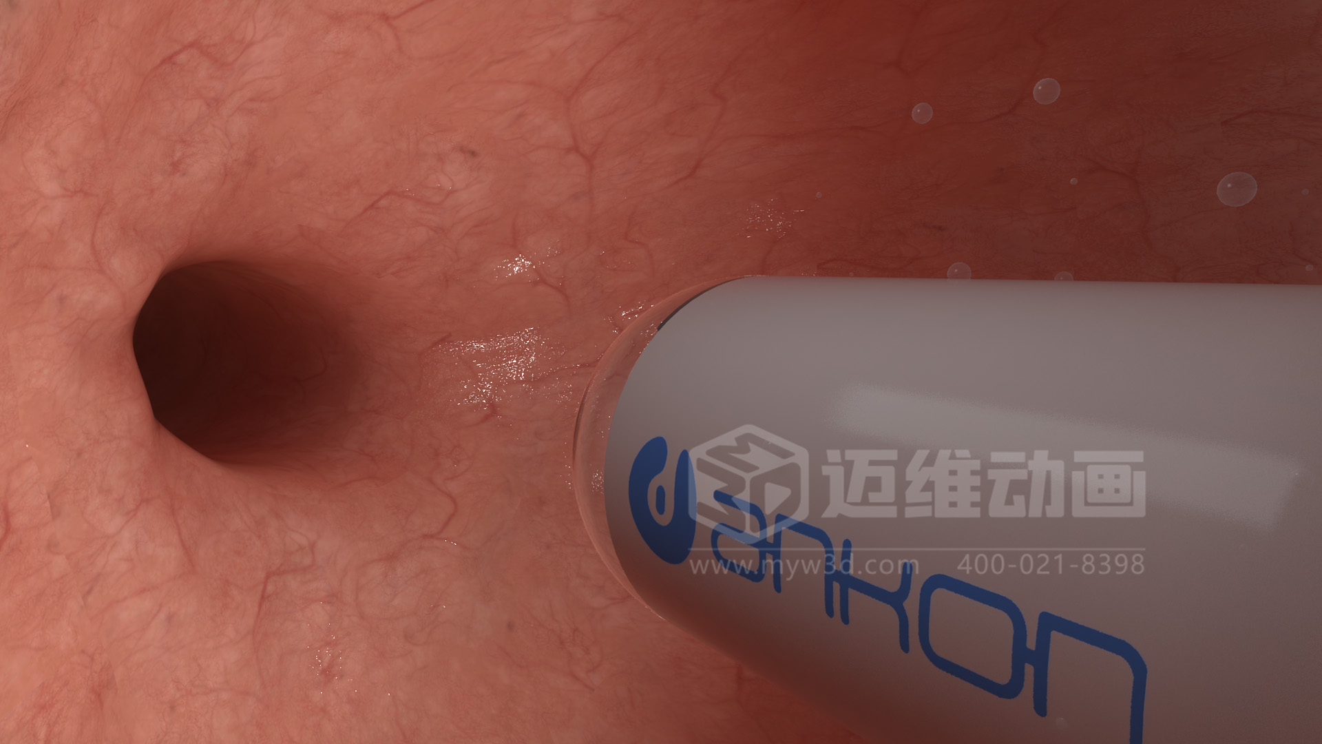 醫(yī)學(xué)檢測設(shè)備如何突破消化道檢查壁壘？三維動(dòng)畫還原核心技術(shù)與臨床價(jià)值(圖4)